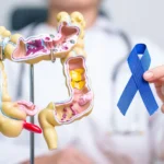 Colon Cancer Screening Appointment