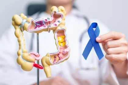Colon Cancer Screening Appointment