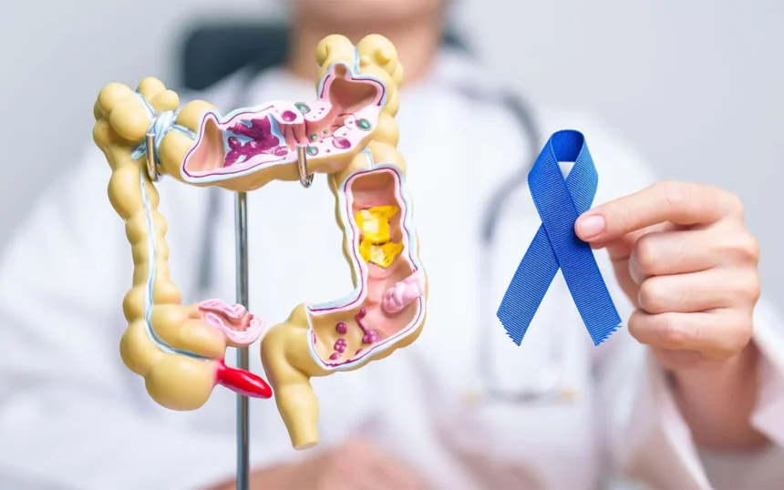 Colon Cancer Screening Appointment