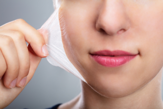 Benefits of Chemical Peels