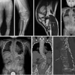 Pediatric Imaging