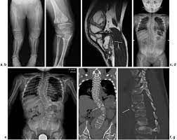 Pediatric Imaging