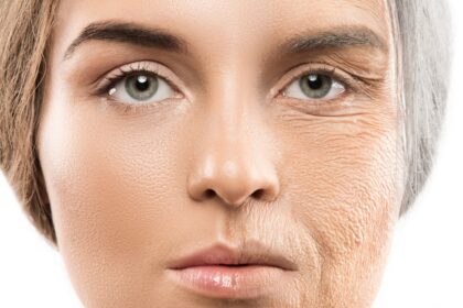 Cosmetic Surgery and Aging