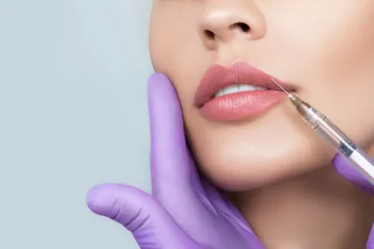 Dermal Fillers