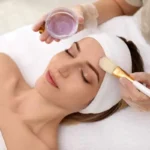 Getting a Chemical Peel