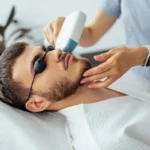 Laser Hair Removal