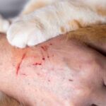 Role of Vaccinations