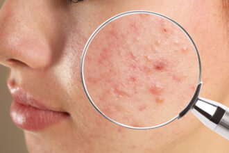 Skin Conditions Treated by Dermatologists