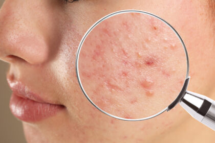 Skin Conditions Treated by Dermatologists