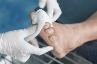 Diabetic Wound Care Solutions