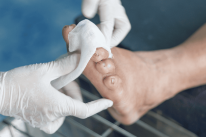 Diabetic Wound Care Solutions