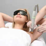 Laser Hair Removal Technologies
