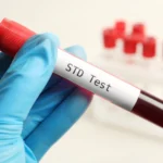 Regular STD Screening