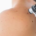 Skin Cancer Detection