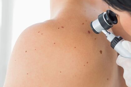 Skin Cancer Detection